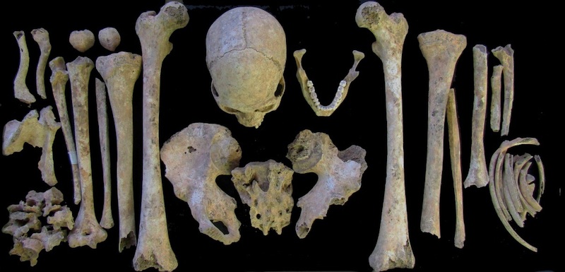 ossa scheletro