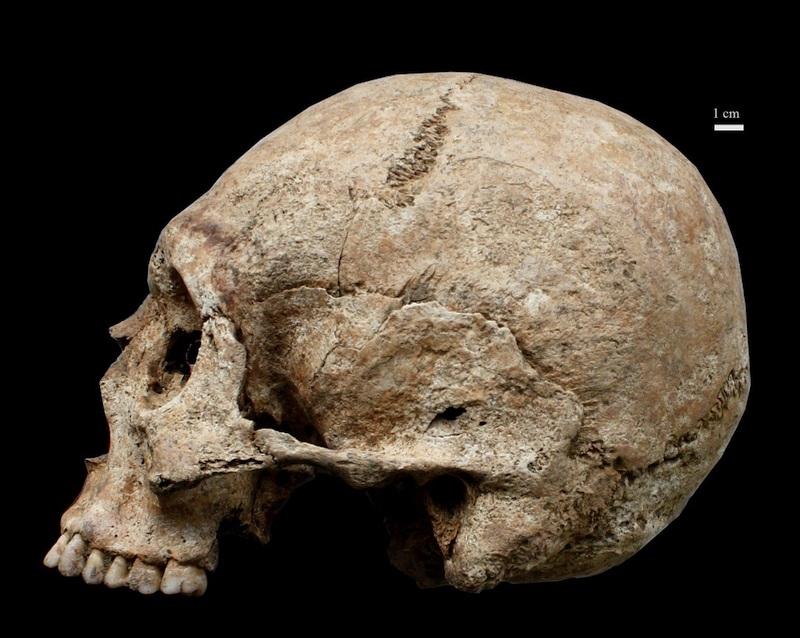cranio individuo isola sacra